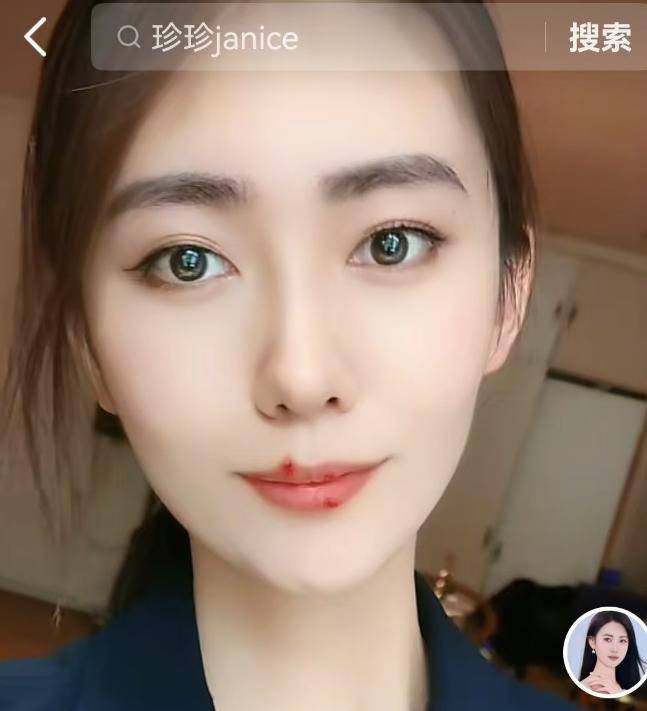 电梯门后续:宋珍珍自曝19岁报警无用,生死看淡