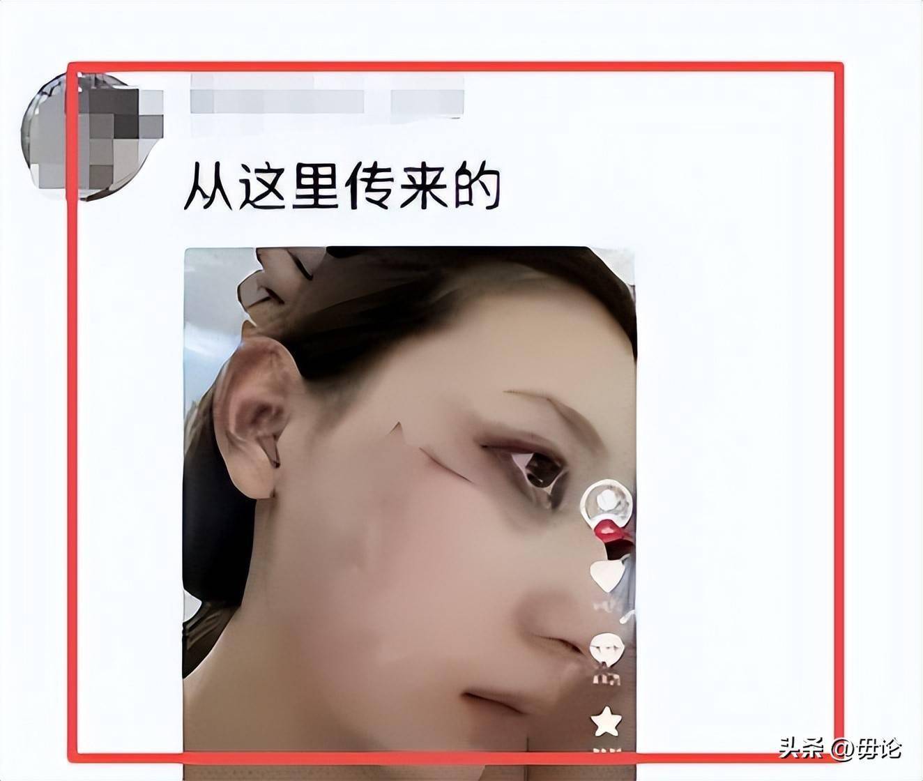 张百乔小雪售别墅,一年零互动疑婚变